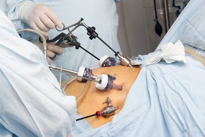 Gallbladder Surgery