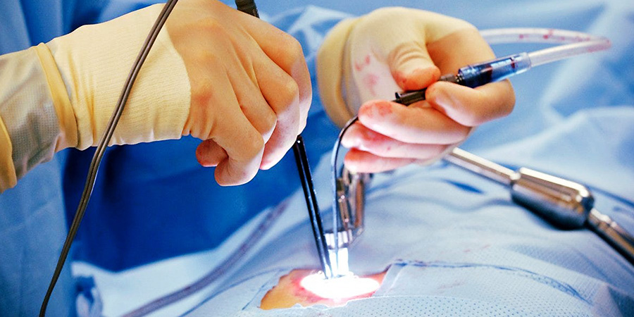 General Laser Surgeries